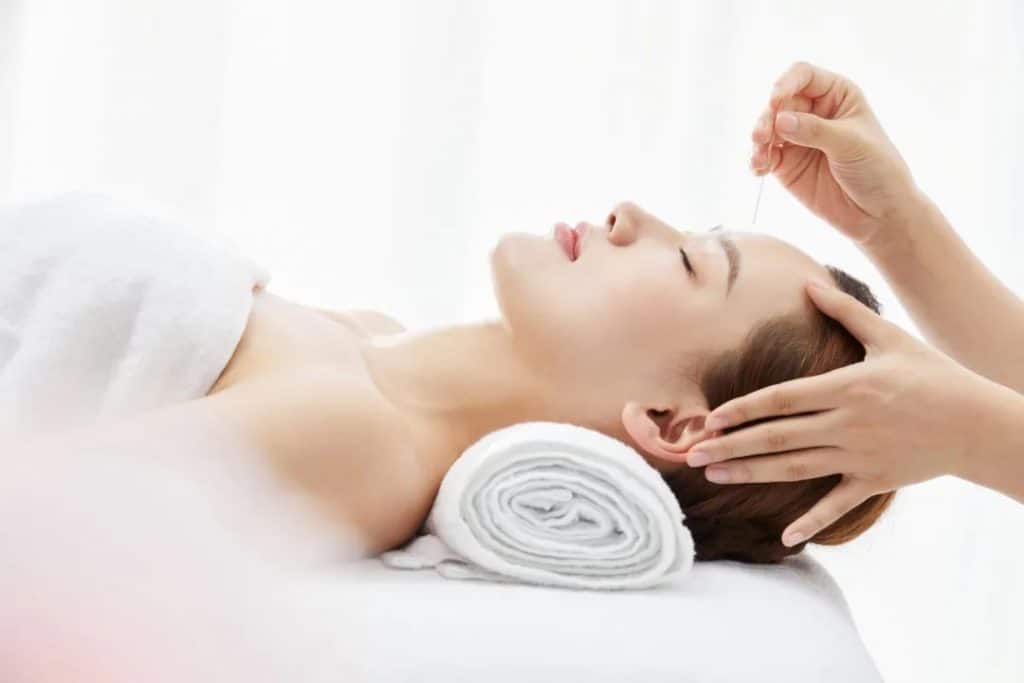 Conditions 1 acupuncture treatment on the face at Almond Wellness Centre