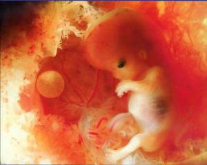 10 weeks fetus pregnancy