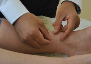 acupuncture for period pain