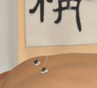 moxibustion on the back