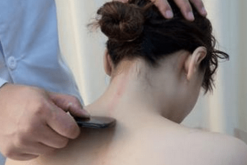 Gua Sha Therapy 1 gua sha therapy at Almond Wellness Centre Melbourne