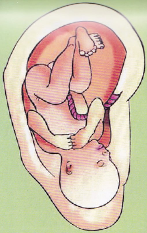 Auricular Acupuncture 2 inverted fetus ear acupuncture points