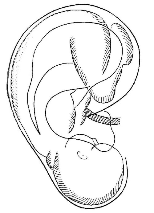 inverted fetus ear acupuncture points