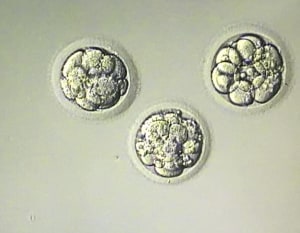 IVF embryos