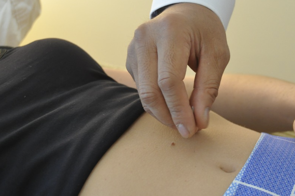 acupuncture for endometriosis and period pain