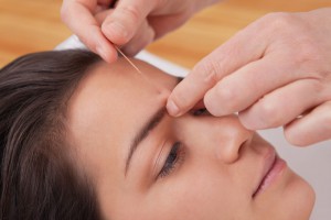 Yin Tang - acupuncture for anxiety