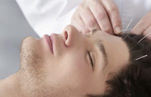 Natural Pain Management Acupuncture Melbourne 5 acupuncture for migraine headache at Almond Wellness Centre Melbourne
