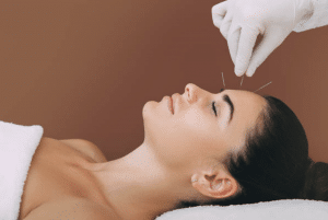 About Us 1 relieve stress and improve sleep with acupuncture