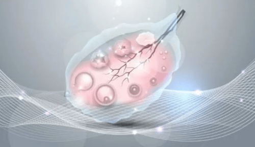 Acupuncture Chinese Medicine for Primary Ovarian Insufficiency (POI): A Case Report 3 ovariy's health acupuncture Melbourne