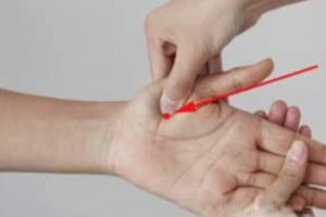 acupuncture point Yu Ji LU10