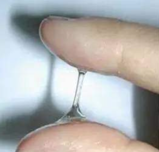 6 Ways to Check Your Ovulation 3 fertile mucus during ovulation