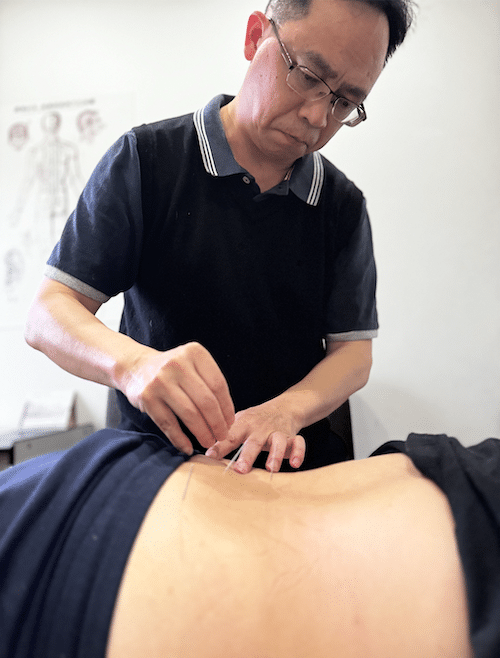 Dr. Clay Chen - Dry Needle Remedial Massage