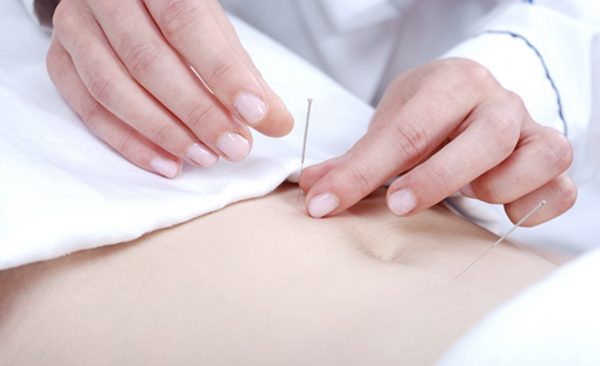 IVF acupuncture Melbourne