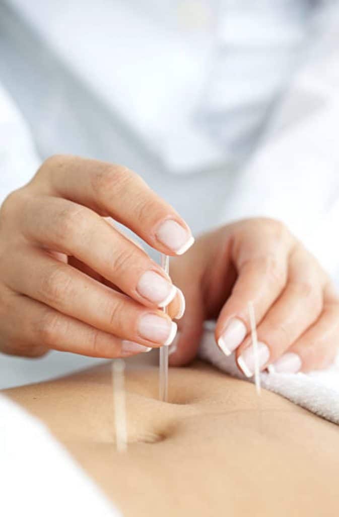 Period Pain 2 A acupuncturist at Almond Wellness Centre in Melbourne provides gentle acupuncture for period pain relief
