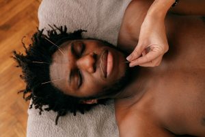 Fertility Acupuncture Melbourne 8 Acupuncture treatment for male infertility at Almond Wellness Centre in Melbourne