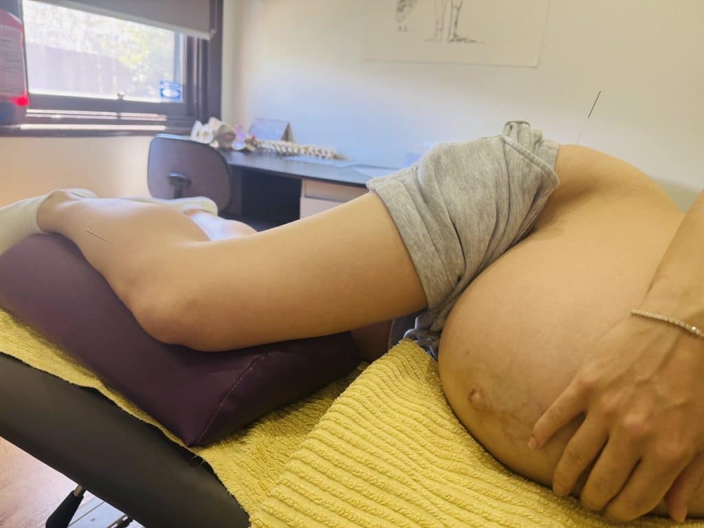 Almond Wellness Centre 2 Pregnancy acupuncture treatment at Almond Wellness Centre Melbourne