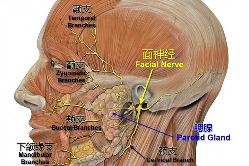 Acupuncture For Bell’s Palsy Melbourne 3 Facial nerve pathway and areas affected in Bell’s palsy and Ramsay Hunt syndrome