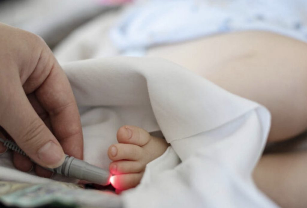 Paediatric Acupuncture Melbourne 1 paediatric Chinese medicine - laser acupuncture for children Melbourne
