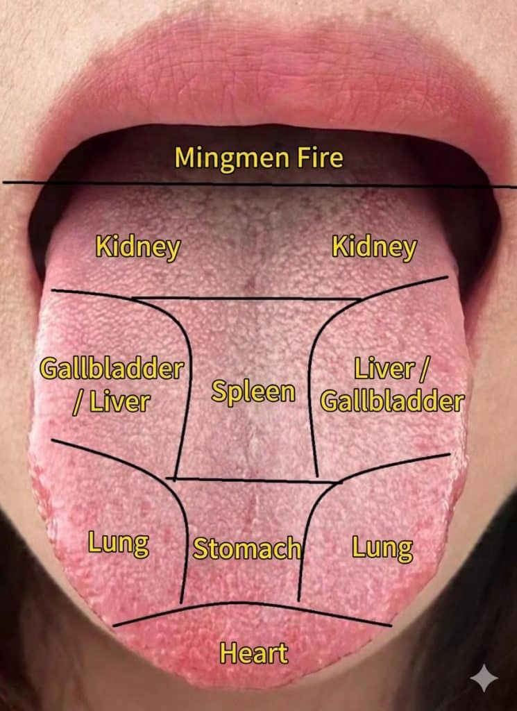 Pattern Diagnosis 2 TCM Tongue Diagnosis at Acupuncture Melbourne