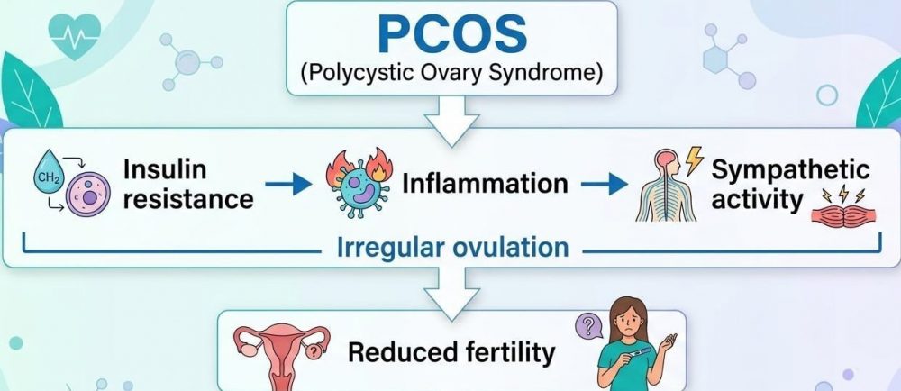 Acupuncture for PCOS: What the Latest Research Really Shows 4 PCOS and reduced fertility infographic